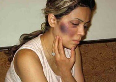 Abused Woman