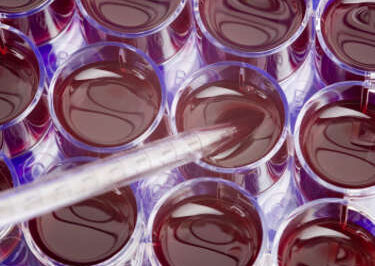 Pro-Lifers Decry Stem Cell Order