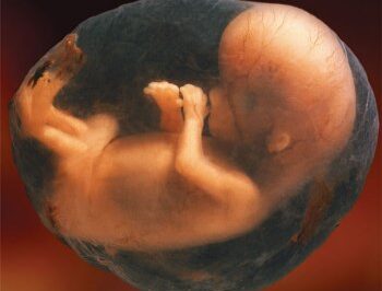 911 Call Reveals Botched First Trimester Abortion