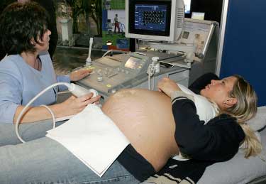 Ultraouns pregnant woman