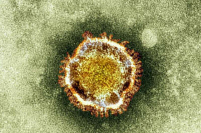 Brit Dies after Contracting New SARS-Like Virus