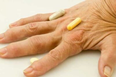 arthritic fingers