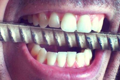 Teeth on metal bar