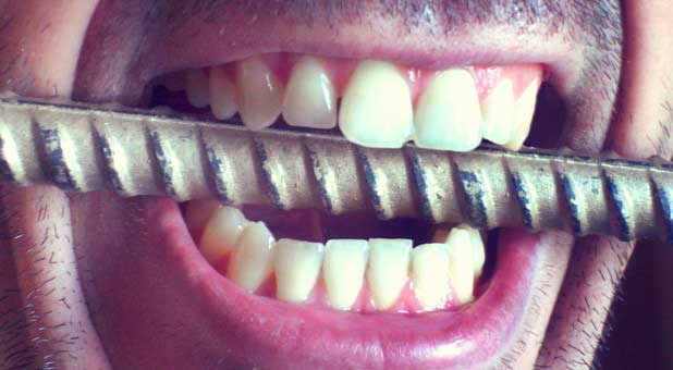 Teeth on metal bar