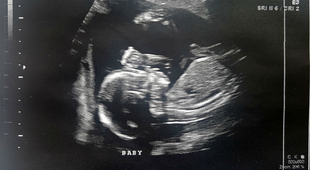 There were no sonograms back then revealing a child's in utero compartment of comfort.